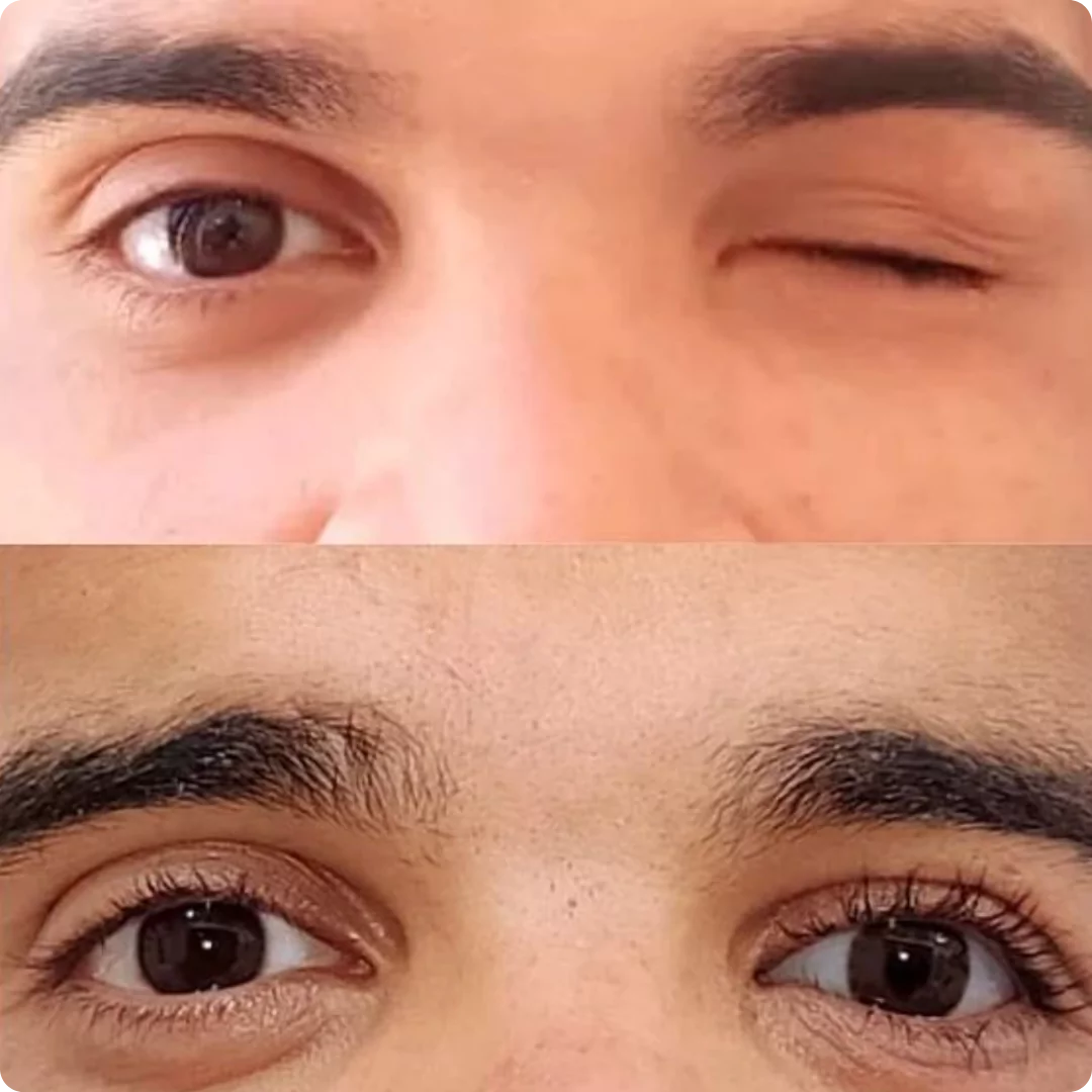 Transformação 6